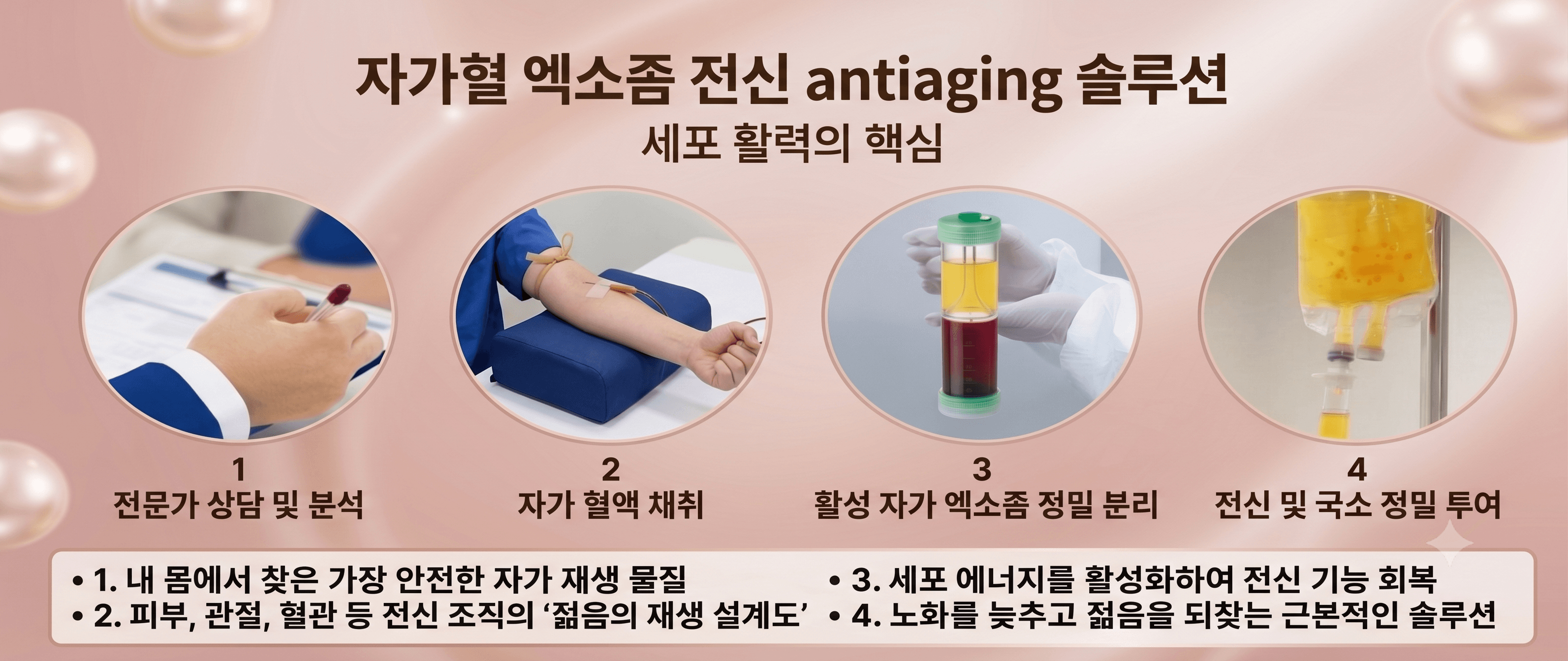 항노화·엑소좀 진료 이미지